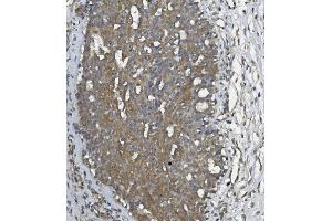 IHC analysis of ULBP1 using anti ULBP1 antibody (ABIN7600996).