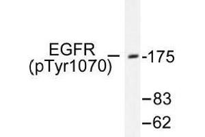Image no. 1 for anti-Epidermal Growth Factor Receptor (EGFR) (pSer1070) antibody (ABIN318325) (EGFR antibody  (pSer1070))