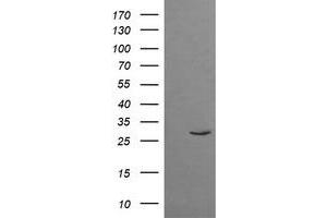 Image no. 1 for anti-Tripartite Motif Containing 38 (TRIM38) (AA 1-265) antibody (ABIN1490688) (TRIM38 antibody  (AA 1-265))