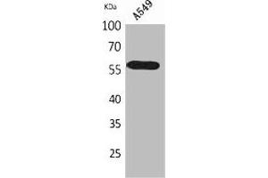 Western Blot analysis of A549 cells using ALDH2 Polyclonal Antibody. (ALDH2 antibody  (N-Term))