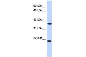WB Suggested Anti-TMEM74 Antibody Titration: 0. (TMEM74 antibody  (Middle Region))