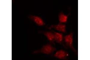 ABIN6266688 staining HepG2 by IF/ICC. (CDK2AP1 antibody  (C-Term))