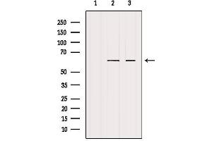Western blot analysis of extracts from various samples, using Cytochrome P450 4F22 Antibody. (CYP4F22 antibody)