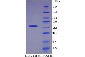 SDS-PAGE of Protein Standard from the Kit  (Highly purified E. (MMP3 ELISA Kit)