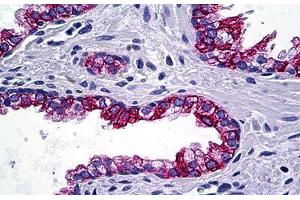 Human Prostate: Formalin-Fixed, Paraffin-Embedded (FFPE) (KRT4 antibody  (AA 194-301))