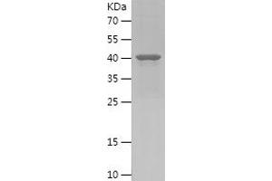 Western Blotting (WB) image for Pleckstrin Homology Domain Containing, Family B (Evectins) Member 1 (PLEKHB1) (AA 30-199) protein (His-IF2DI Tag) (ABIN7284066) (PLEKHB1 Protein (AA 30-199) (His-IF2DI Tag))