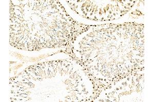 ABIN6258847 and ABIN6275709 at 1/100 staining Rat testis tissue by IHC-P.