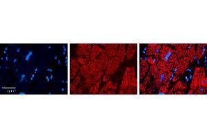 Rabbit Anti-CPT2 Antibody   Formalin Fixed Paraffin Embedded Tissue: Human heart Tissue Observed Staining: Cytoplasmic in mitochondria Primary Antibody Concentration: 1:100 Other Working Concentrations: 1:600 Secondary Antibody: Donkey anti-Rabbit-Cy3 Secondary Antibody Concentration: 1:200 Magnification: 20X Exposure Time: 0. (CPT2 antibody  (N-Term))