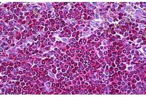 Anti-NF1 antibody IHC staining of human spleen. (Neurofibromin 1 antibody  (AA 1551-1600))