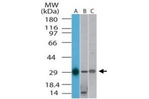 Western blot analysis of TLX1 in A) human, B) mouse and C) rat liver lysate.