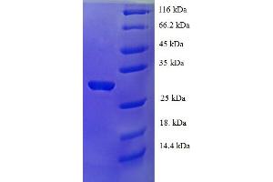 SDS-PAGE (SDS) image for P53 and DNA-Damage Regulated 1 (PDRG1) (AA 1-133), (full length) protein (His-SUMO Tag) (ABIN4974354)