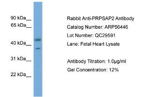WB Suggested Anti-PRPSAP2  Antibody Titration: 0. (PRPSAP2 antibody  (Middle Region))