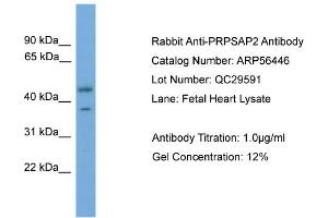WB Suggested Anti-PRPSAP2  Antibody Titration: 0. (PRPSAP2 antibody  (Middle Region))