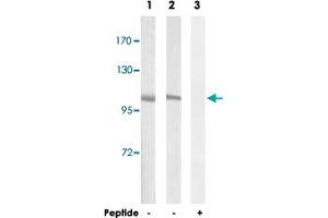 Western blot analysis of extracts from A-549 cells (Lane 1 and lane 3) and NIH/3T3 cells (Lane 2), using CNGB1 polyclonal antibody .