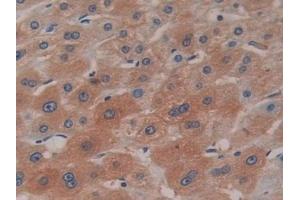 Immunohistochemistry (IHC) image for anti-Ceruloplasmin (Ferroxidase) (CP) (AA 789-1065) antibody (ABIN7426115)