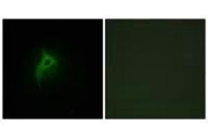 Immunofluorescence analysis of HepG2 cells, using Adrenergic Receptor alpha-2B antibody. (ADRA2B antibody)