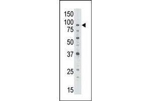 Image no. 1 for anti-ATP-Binding Cassette, Sub-Family B (MDR/TAP), Member 7 (ABCB7) (C-Term) antibody (ABIN358593) (ABCB7 antibody  (C-Term))