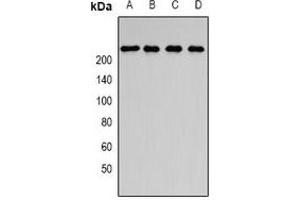 Western blot analysis of SMCHD1 expression in SKOV3 (A), Jurkat (B), HepG2 (C), rat brain (D) whole cell lysates. (SMCHD1 antibody)