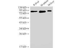 Western Blot analysis of Rat liver, Mouse spleen and Mouse liver using IL6R Polyclonal Antibody at dilution of 1:2000 (IL-6 Receptor antibody)