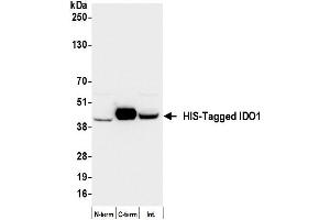 Western Blotting (WB) image for anti-His Tag antibody (ABIN7795586) (Recombinant His Tag antibody)
