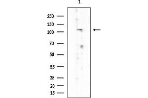 Western blot analysis of lysates from COLO205 cells, using MYPT1 Mouse Monoclonal Antibody at 1/1000 dilution.