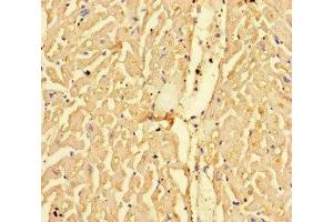 Immunohistochemistry of paraffin-embedded human heart tissue using ABIN7146833 at dilution of 1:100 (CPT1A antibody  (AA 301-600))