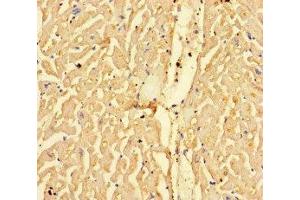 Immunohistochemistry of paraffin-embedded human heart tissue using ABIN7146833 at dilution of 1:100