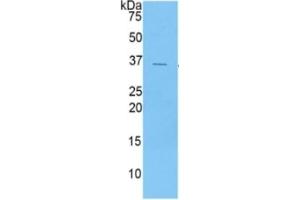 Western Blotting (WB) image for Chemokine (C-X-C Motif) Ligand 5 (CXCL5) ELISA Kit (ABIN6730954)