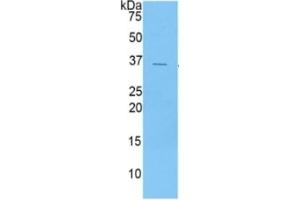 WB of Protein Standard: different control antibodies  against Highly purified E. (CXCL5 ELISA Kit)