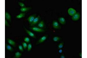 Immunofluorescent analysis of A549 cells using ABIN7148523 at dilution of 1:100 and Alexa Fluor 488-congugated AffiniPure Goat Anti-Rabbit IgG(H+L) (Copine IV antibody  (AA 1-280))