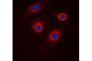Immunofluorescent analysis of GCNT7 staining in HeLa cells.