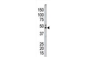 The anti-SPHK1 Pab is used in Western blot to detect SPHK1 in mouse kidney tissue lysate. (SPHK1 antibody  (AA 286-315))