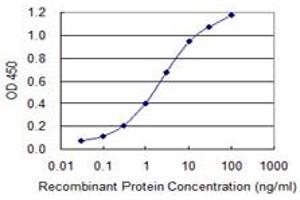 Detection limit for recombinant GST tagged FTCD is 0. (FTCD antibody  (AA 440-541))