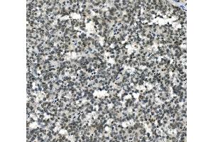 IHC analysis of HOXD11 using anti-HOXD11 antibody (ABIN7603174). (HOXD11 antibody  (N-Term))