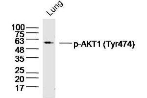 Mouse lung lysates probed with AKT1/2/3 (Tyr474) Polyclonal Antibody, unconjugated  at 1:300 overnight at 4°C followed by a conjugated secondary antibody at 1:10000 for 90 minutes at 37°C. (AKT 1/2/3 antibody  (pTyr474))