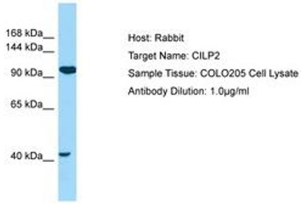 Cilp2 抗体  (AA 112-161)