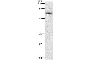 Western blot analysis of Hela cell, using PKM2 Polyclonal Antibody at dilution of 1:450 (PKM antibody)