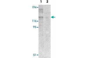 Western blot analysis of NLRP8 in human colon tissue lysate with NLRP8 polyclonal antibody  at 1 ug/mL in (1) the absence and (2) the presence of blocking peptide. (NALP8 antibody  (N-Term))