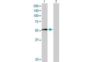 Western Blot analysis of PNPLA3 expression in transfected 293T cell line by PNPLA3 MaxPab polyclonal antibody. (PNPLA3 antibody  (AA 1-481))