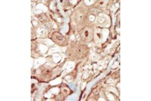 Image no. 2 for anti-Platelet Derived Growth Factor Receptor beta (PDGFRB) (N-Term) antibody (ABIN359919) (PDGFRB antibody  (N-Term))