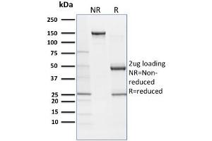 SDS-PAGE Analysis Purified SOX9 Mouse Monoclonal Antibody (SOX9/2387).