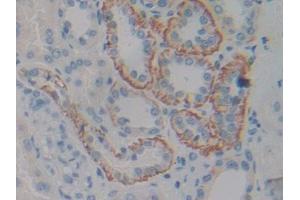 IHC-P analysis of Human Kidney Tissue, with DAB staining. (CNTF Receptor alpha antibody  (AA 120-358))