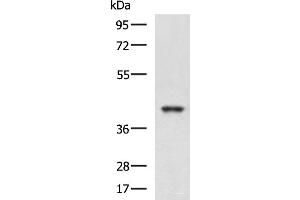 Western blot analysis of K562 and HepG2 cell lysates using RBM4 Polyclonal Antibody at dilution of 1:750 (RBM4 antibody)