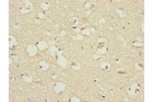 Immunohistochemistry of paraffin-embedded human brain tissue using ABIN7147433 at dilution of 1:100 (CCDC41 antibody  (AA 34-260))