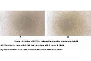 Image no. 2 for Interleukin 24 (IL24) (AA 51-206) (Active) protein (His tag) (ABIN6239770) (IL-24 Protein (AA 51-206) (His tag))