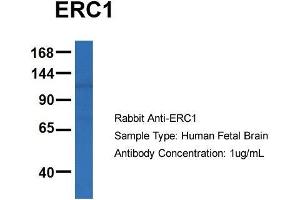 Host: Rabbit  Target Name: ERC1  Sample Tissue: Human Fetal Brain  Antibody Dilution: 1. (ERC1 antibody  (C-Term))