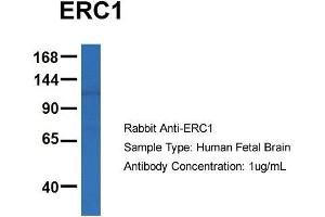 Host: Rabbit  Target Name: ERC1  Sample Tissue: Human Fetal Brain  Antibody Dilution: 1.