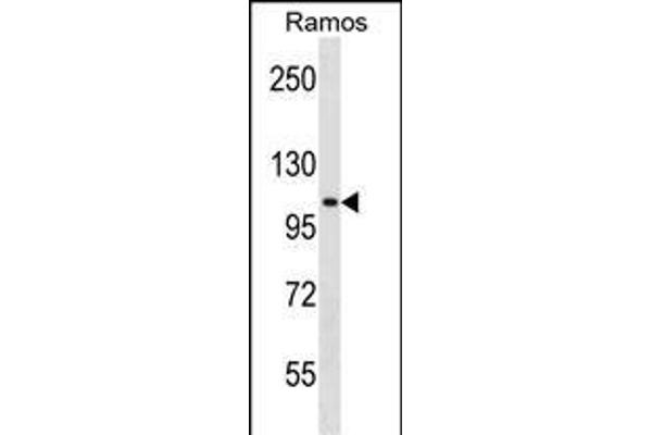 TACC1 antibody  (N-Term)