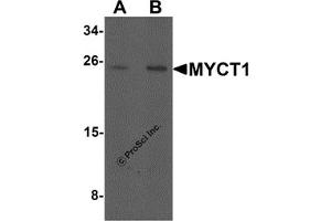 Western Blotting (WB) image for anti-Myc Target 1 (MYCT1) (C-Term) antibody (ABIN1077374)