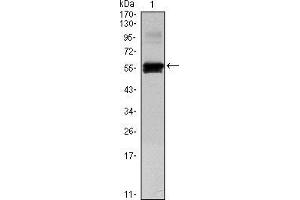 Western blot analysis using PAX6 mAb against human PAX6 (AA: 1-223) recombinant protein. (PAX6 antibody)